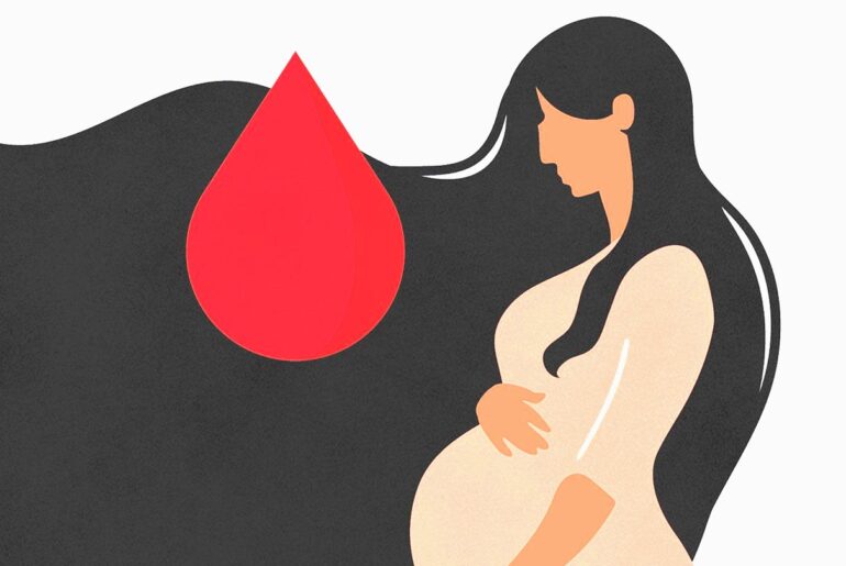 Understanding the Causes and Implications of Bleeding During Early Pregnancy