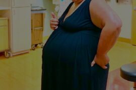Delivery Risks in Overweight Mom