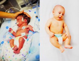 How to Understanding Preterm and Post-term Births