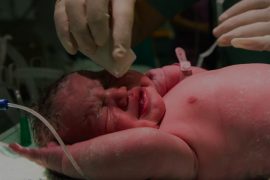 The First Hours After Birth: Understanding Immediate Newborn Needs